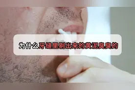 牙缝里隐藏着什么，为什么抠出来的黄泥味道如此熏人？视频封面