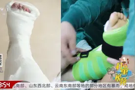 院士说科技：液态金属外骨骼支具|生活圈视频封面