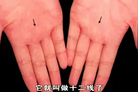 手掌纹十二线代表着肝损伤，十三线代表着免疫性疾病视频封面
