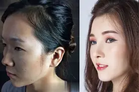 4个越南丑女学生脸部整容，效果逆天，这颜值太漂亮啦！视频封面