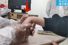 手背长个包，可能是腱鞘囊肿，专业手法处理！视频封面