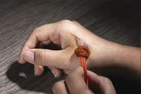 烫伤处理需谨慎，碘伏和“它”搭配，消毒除菌，促进创面更快愈合视频封面