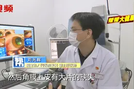 剧毒！上山竟遇上了眼镜蛇！这种毒液让男子险些失明视频封面