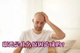 不小心被“鬼剃头”，斑秃是什么原因造成的？药师来回答视频封面