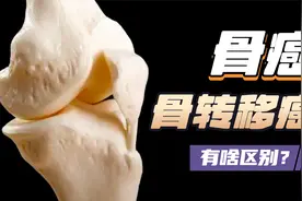 好奇：骨癌和骨转移癌之间，到底有何区别？视频封面