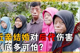 近亲结婚究竟多可怕？日本皇室生15个死11个，欧洲直接覆灭一王朝视频封面