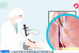 厉害了！上海科学家为深层肿瘤治疗提供新方案，光动力治疗取成效视频封面