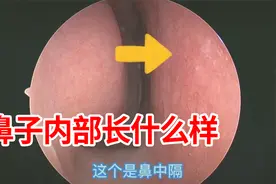为什么我治鼻炎能直达病灶，鼻子里面是什么样子，跟着中医一起看视频封面