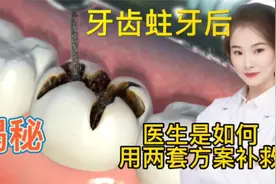 医学演绎 人体牙齿蛀牙，看医生如何利用两套方案治疗 牙套牙冠视频封面
