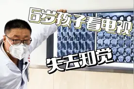 6岁孩子看电视突然失去知觉，拍片发现S型颈椎和小脑扁桃体下疝视频封面