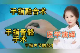 医学演绎 人体手指关节发炎 移位骨骼坏死 看医生进行融合关节术视频封面