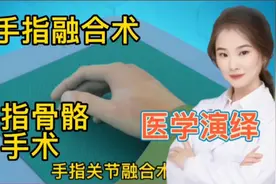 医学演绎 人体手指关节发炎 移位骨骼坏死 看医生进行融合关节术视频封面