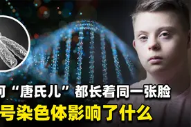 为什么唐氏综合症患者，长相都差不多？该如何预防这种疾病？视频封面