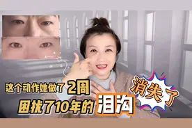 47岁大妈没有泪沟的秘密，不用填充，一个动作坚持2周，变化惊喜