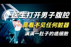 真实事件！湖北一男子内脏器官被满满的肿瘤和粘液覆盖，结局如何视频封面