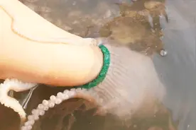 小章赶海捡海星，被一只大章鱼用吸盘紧紧吸住手臂。手都吸疼了！视频封面