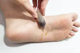 在脚底抹点藿香正气水，好多人不知道有啥用，看完感觉自己赚到了