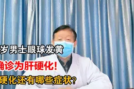 52岁男士眼球发黄，确诊为肝硬化！肝硬化还有哪些症状？视频封面