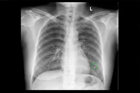 胸部X线片正常表现视频封面