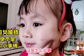 小闺女在幼儿园被淘气的小朋友挠伤，这不是一件小事需要足够重视视频封面