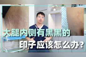 大腿内侧有黑黑的印子，怎么擦也擦不掉，应该怎么办？