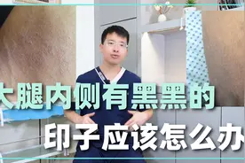 大腿内侧有黑黑的印子，怎么擦也擦不掉，应该怎么办？