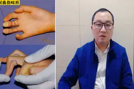 孩子的手伸不直？能修复吗？我是汪大夫，请听我说。@西瓜视频视频封面