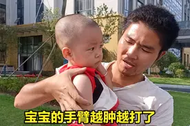 宝宝打疫苗2天了，手臂肿的越来越大了，这该怎么办才好视频封面