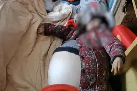 腹大如巨球！山东六旬老太患腹水体重400斤，消防员1小时才抬下楼视频封面