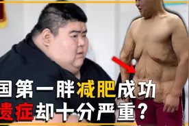 中国第一胖王浩楠680斤，减肥成功获爱情，肥胖究竟会带来什么？视频封面