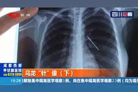 乌龙“针”像！孕妇身体里现钢针？竟是医院误诊，孩子也没保住视频封面