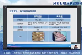 手癣、足癣你都认得吗？专家教你如何区分手足癣、湿疹、汗疱疹视频封面