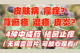 4种中成药，用于皮肤病瘙痒、荨麻疹、湿疹，祛风止痒，养血祛湿视频封面