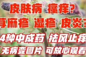 4种中成药，用于皮肤病瘙痒、荨麻疹、湿疹，祛风止痒，养血祛湿视频封面