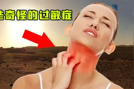 那些奇怪的过敏症！对冷空气过敏，一冷就难受，连冰淇淋都不能吃