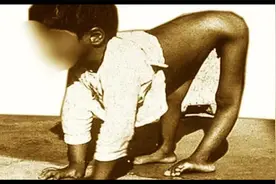 从铁肺到疫苗：小儿麻痹症的历史！视频封面