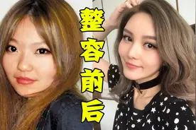 明星整容后：贾乃亮“削骨”迎事业巅峰，周扬青放入假体一路起飞视频封面