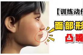 面部形态—凸嘴！视频封面