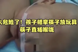 儿童被筷子直插喉咙.mp4视频封面