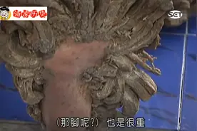 印尼怪异“树人”：得怪病手脚长得像树根，只能街头卖艺维生！视频封面