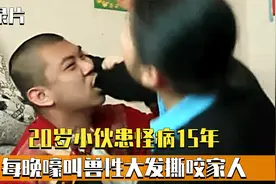 20岁小伙患怪病15年，每晚如狼人嚎叫，兽性大发撕咬家人！纪录片视频封面