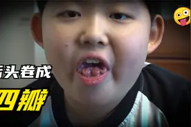 男孩的舌头能开花，练习时长两年半后，他的目标是卷成7瓣！视频封面