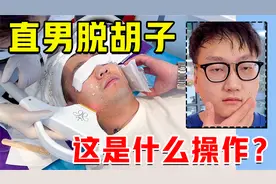 直男体验光子嫩肤脱络腮胡？！视频封面
