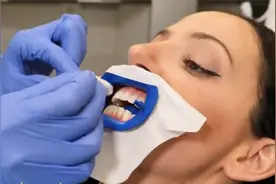 【生活新花样】国外美女体验牙齿美白视频封面