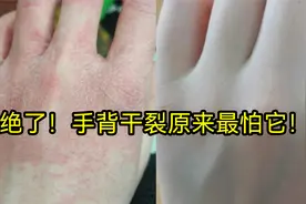 后悔才知道！原来手背开裂最怕它！过来人教你在家3天就能解决！视频封面