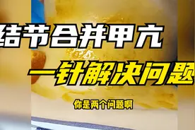 结节甲亢成功消融，一针解决两个大问题！视频封面