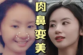 鼻子变小巧精致！放松锻炼鼻周是关键～
