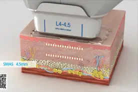 Ultraformer III 7D聚拉提治疗原理高清视频视频封面