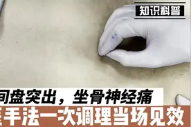腰间盘突出压迫坐骨神经痛，腿痛腿脚发麻，浅筋膜松解术一次见效视频封面