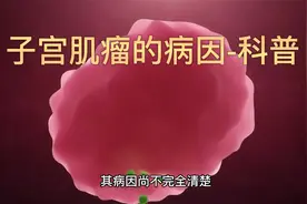子宫肌瘤的病因-科普视频封面